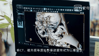 微信图片_20201106085654.gif